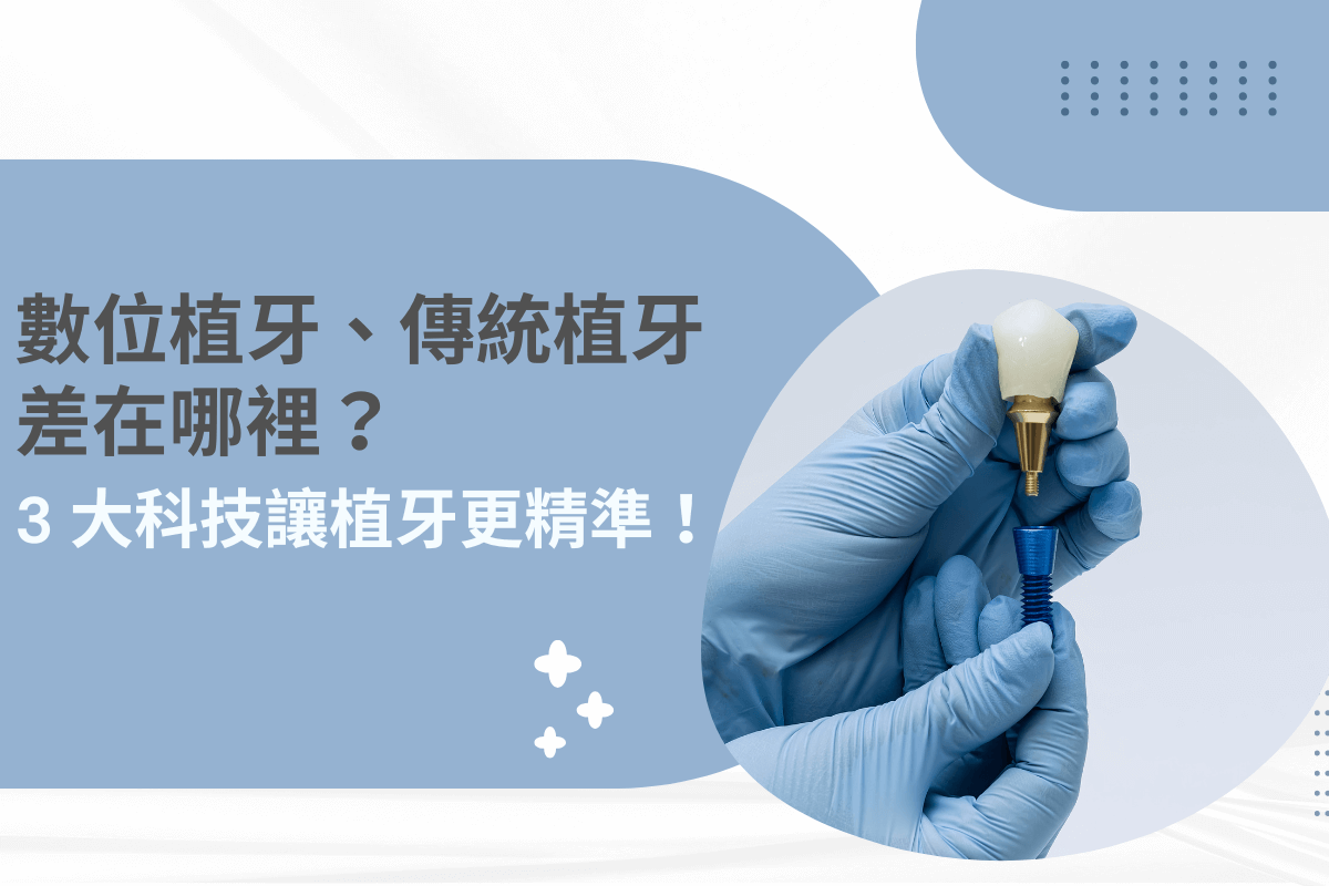 數位植牙與傳統植牙有何不同？3 大科技提升植牙精準度