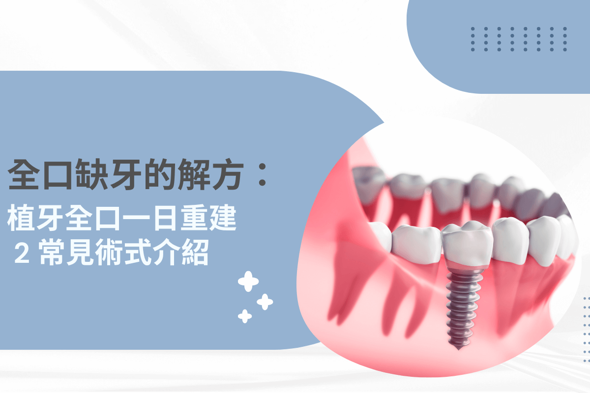 全口缺牙的解方：植牙全口一日重建，2 種常見術式介紹