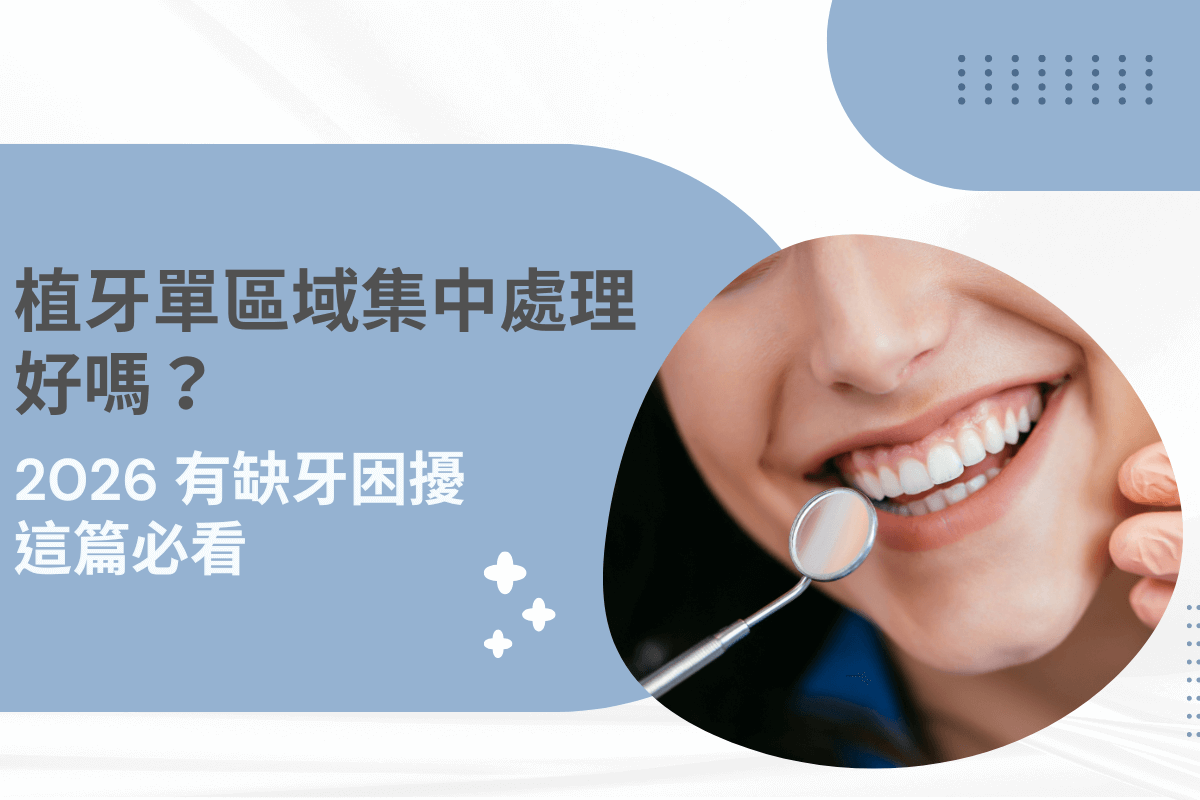 植牙單區域集中處理好嗎？2026 缺牙解決方案必看