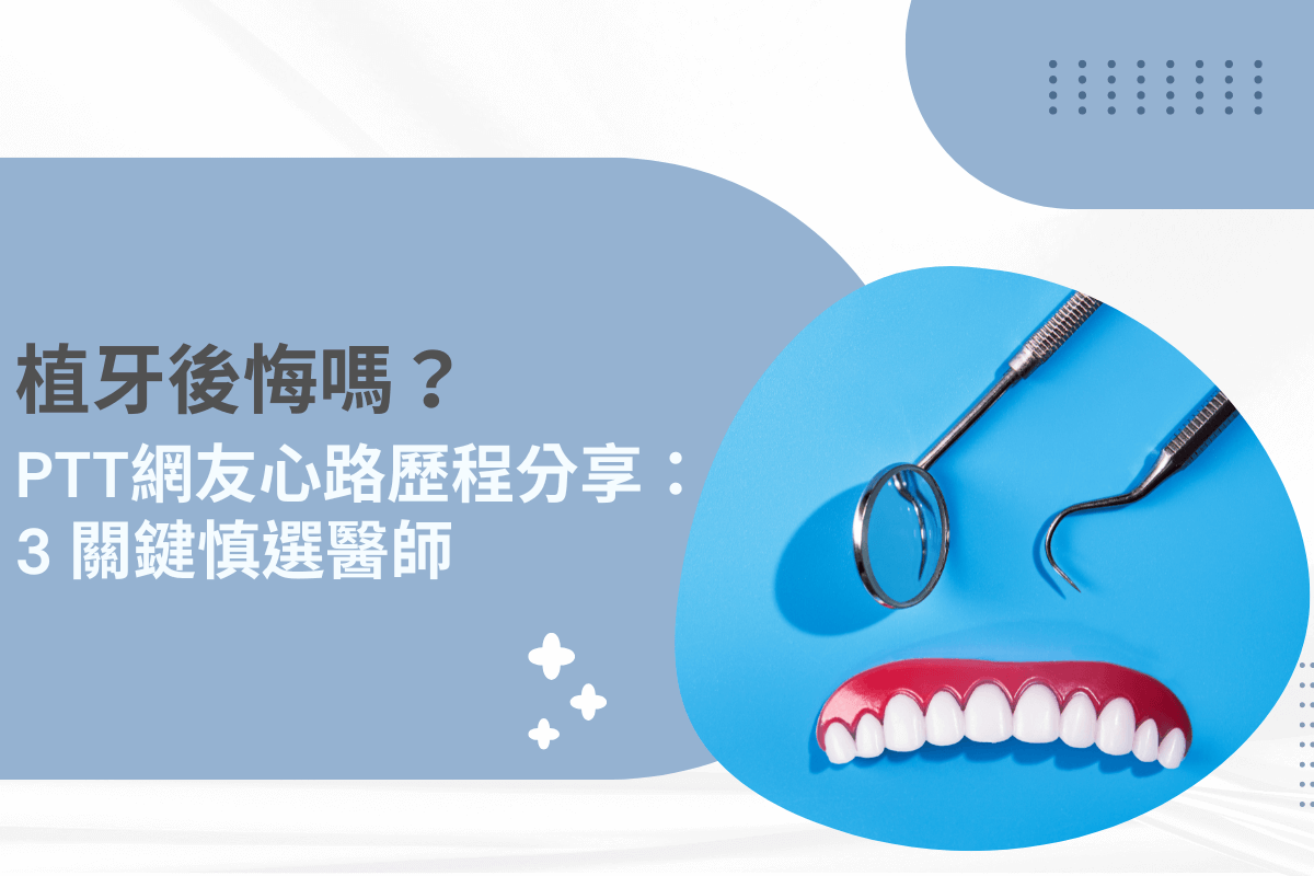 植牙後悔嗎？PTT 網友經驗分享：3 關鍵教你如何慎選醫師