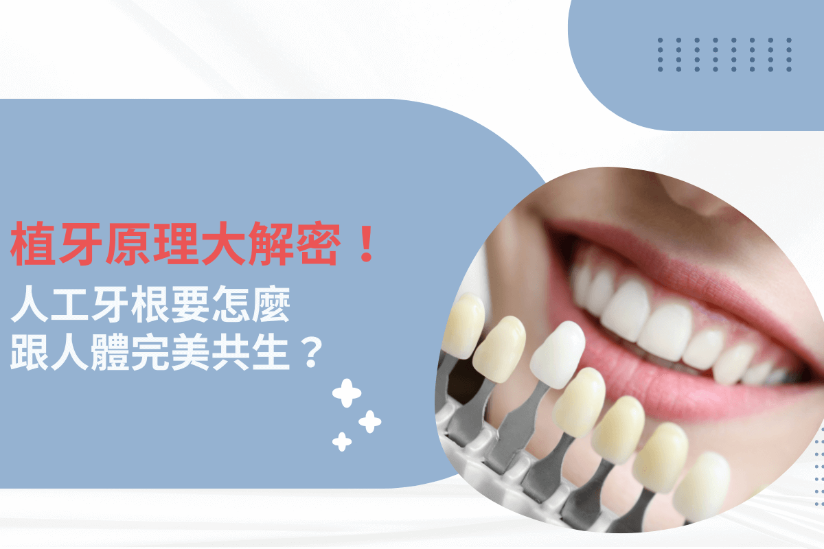 植牙原理大解密！人工牙根如何與人體完美共生？