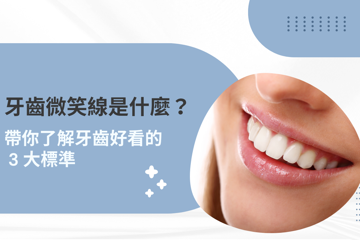 牙齒微笑線是什麼？帶你了解牙齒好看的 3 大標準