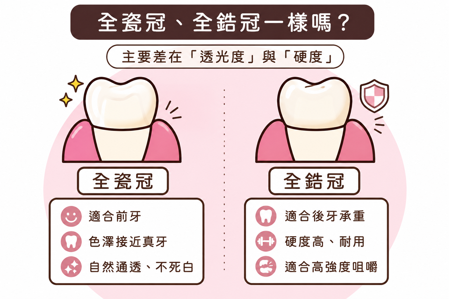 全瓷冠、全鋯冠一樣嗎?主要差別與適用對象解析
